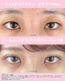 クイックコスメティークダブル after画像 サムネイル用