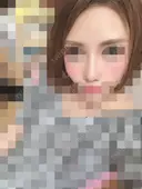 鼻の手術 28日後 サムネイル用