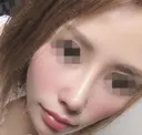 鼻の手術 28日後 サムネイル用