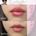 Cカールリップ after画像 サムネイル用