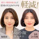 【1day小顔】ダウンタイム少なく垢抜ける♪ before画像 サムネイル用