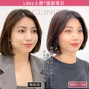 【1day小顔】お顔の余白が少なくなり自然に垢抜け♪ after画像 サムネイル用
