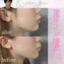Eライン形成 after画像 サムネイル用