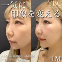 【🐇人中短縮🐇】 after画像 サムネイル用