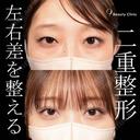 二重埋没 before画像 サムネイル用