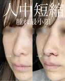 人中短縮 before画像 サムネイル用