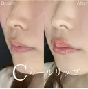 Cカールリップ before画像 サムネイル用