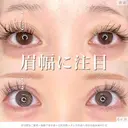全切開法二重術＋眼瞼下垂手術+目尻切開＋タレ目形成＋埋没法抜糸※MD式 180日後 サムネイル用
