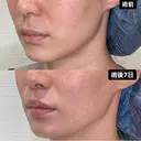 人中短縮 after画像 サムネイル用
