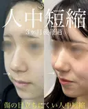人中短縮 before画像 サムネイル用