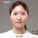 輪郭3点 before画像 サムネイル用