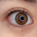 自然に目力アップ！【たれ目形成術,目尻切開法】 before画像 サムネイル用