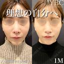 【🌟人中短縮🌟】 after画像 サムネイル用