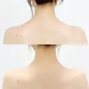 肩こりボトックス注射 before画像 サムネイル用