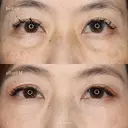 クマ取り before画像 サムネイル用