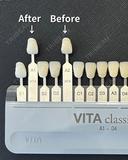 ホワイトニング🦷✨ after画像 サムネイル用