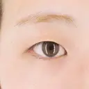 一番可愛くなれるお目もとにします♪二重術埋没法の症例です！【二重術埋没法】 before画像 サムネイル用