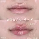 加賀ヒアル×リップ after画像 サムネイル用