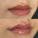 Cカールリップ before画像 サムネイル用