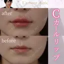 Cカールリップ after画像 サムネイル用