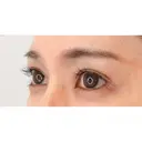 二重術埋没法とパーフェクトアイズの組み合わせで可愛いお目元へ♡処置前と2週間後の症例です【二重術埋没法/たれ目形成術クイック法/目尻切開法】 14日後 サムネイル用