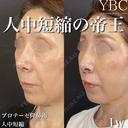 【🦊人中短縮🦊】 after画像 サムネイル用