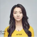 両顎+輪郭2点 after画像 サムネイル用
