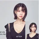 両顎+輪郭2点 after画像 サムネイル用