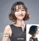 両顎+輪郭3点 after画像 サムネイル用