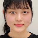 エラ張り解消でスッキリとしたフェイスラインに♪処置後1ヵ月の症例です【小顔エラボトックス注射】 before画像 サムネイル用
