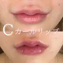 Cカールリップ before画像 サムネイル用