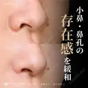 小鼻縮小・鼻翼挙上・鼻孔縁挙上 180日後 サムネイル用
