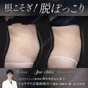 脂肪吸引（腹部） 180日後 サムネイル用