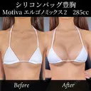 豊胸－シリコンバッグ豊胸－ before画像 サムネイル用