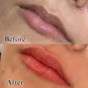 リップアートメイク　1回 before画像 サムネイル用