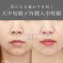 人中短縮術 before画像 サムネイル用