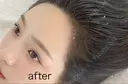 アートメイク　ヘアライン after画像 サムネイル用