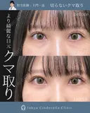 切らないクマ取り 7日後 サムネイル用