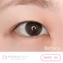 二重埋没 before画像 サムネイル用
