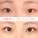二重埋没 before画像 サムネイル用