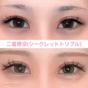 二重埋没 after画像 サムネイル用