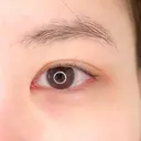 目尻が下がってモテ女子に♪パーフェクトアイズの処置前と処置後2週間の症例です【パーフェクトアイズ】 before画像 サムネイル用