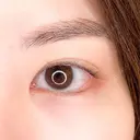 目尻が下がってモテ女子に♪パーフェクトアイズの処置前と処置後2週間の症例です【パーフェクトアイズ】 14日後 サムネイル用