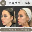 テスリフト 30日後 サムネイル用