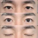 埋没4点留め｜埋没でお目元はっきりとした印象に after画像 サムネイル用