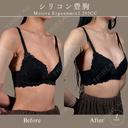 モディバ　シリコンバッグ豊胸 after画像 サムネイル用