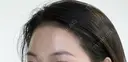 アートメイクヘアライン after画像 サムネイル用