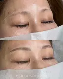 眉アートメイク3D（毛並み） before画像 サムネイル用