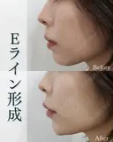 Eライン形成 after画像 サムネイル用