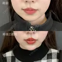 顔の脂肪吸引 +切らない顎形成 3D Eライン+ 顎（あご）のヒアルロン酸注射+ 小顔美肌再生（リフトアップ） before画像 サムネイル用